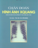 Ebook Chuẩn đoán hình ảnh X-quang (dùng cho đào tạo cao đảng kỹ thuật hình ảnh y học): Phần 1 - ThS. Chu Văn Đặng